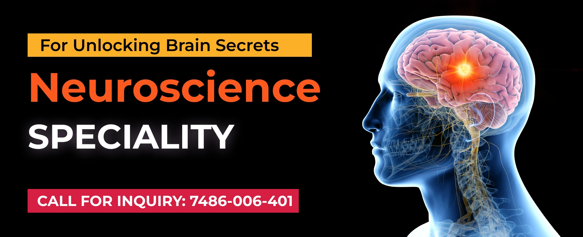 Neurology department in Sanjay hospital